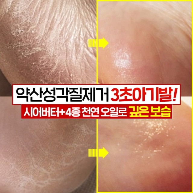 라하 아기발 스크럽 풋스틱