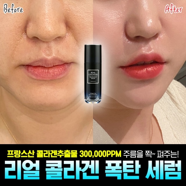 쫀쫀 리프팅 콜라겐30만 폭탄세럼