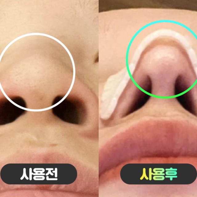 10분 노즈 라이너