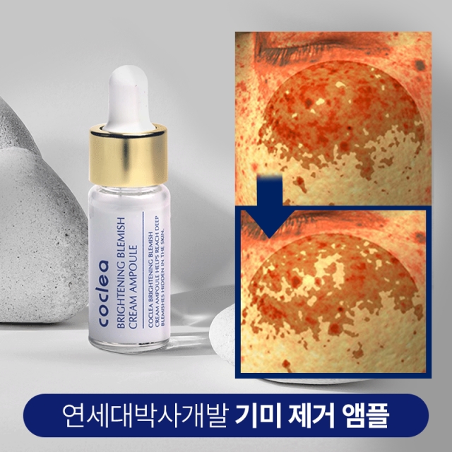 [연세대 박사개발] 기미 제거 앰플